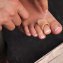Gel-buisverband - 2