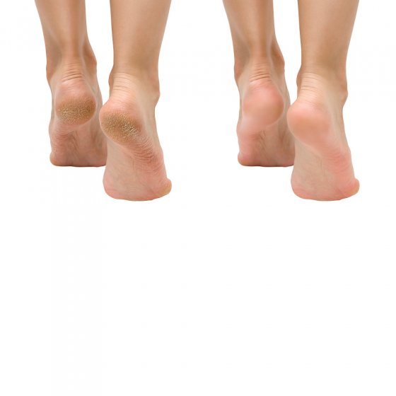 Voet- en nagelschimmelspray 